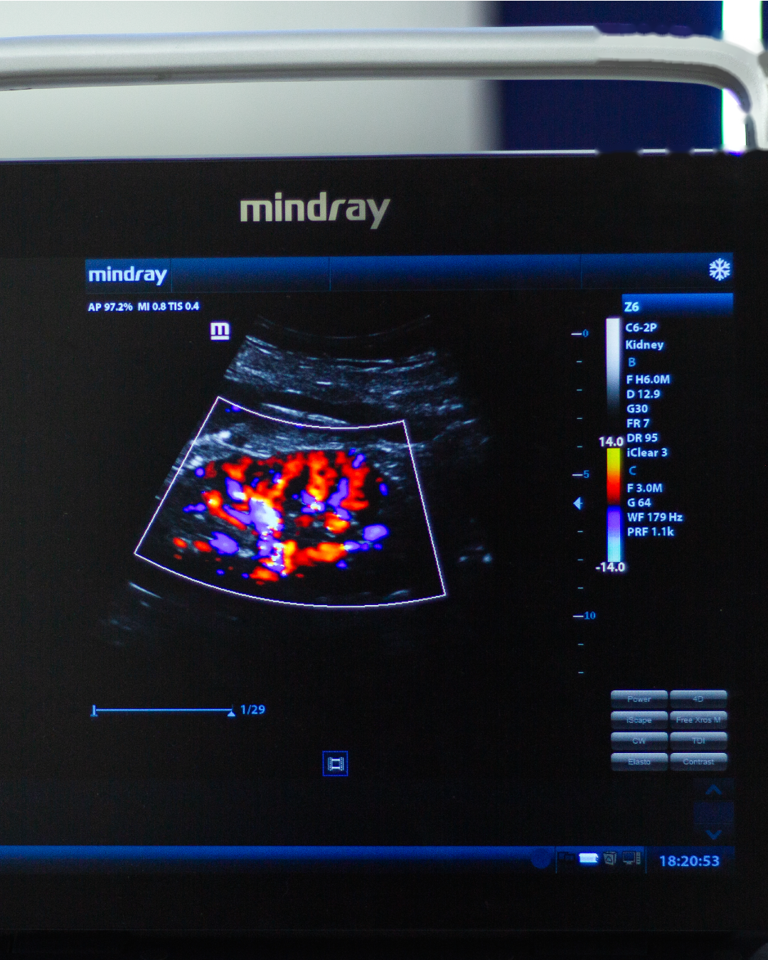 Equipo de ultrasonido portátil de ecografía para uso humano modelo Z60 + Transductores Convexo, Endocavitario y Lineal - Marca Mindray