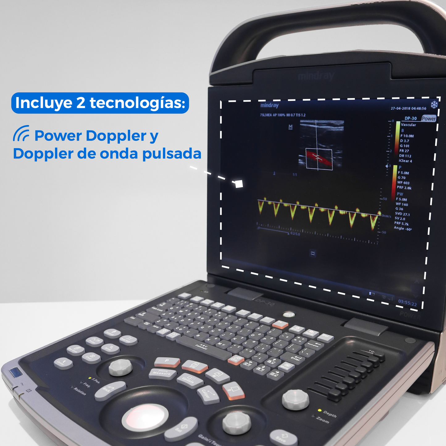 Ultrasonido Portátil para Uso Humano con doppler poder DP30 con optimización automática - Marca Mindray