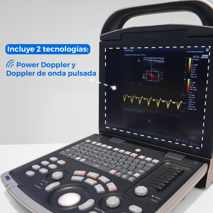 Ultrasonido Portátil para Uso Humano con doppler poder DP30 con optimización automática - Marca Mindray