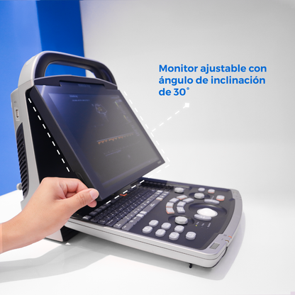 Ultrasonido Portátil para Uso Humano con doppler poder DP30 con optimización automática - Marca Mindray