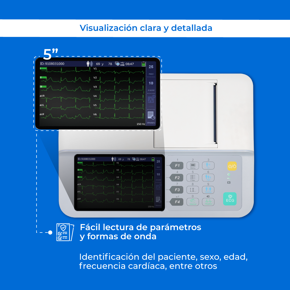 Electrocardiógrafo Portátil de 3 Canales, Pantalla 5 Pulgadas y Alta Resolución / BeneHeart R3 ECG Marca Mindray