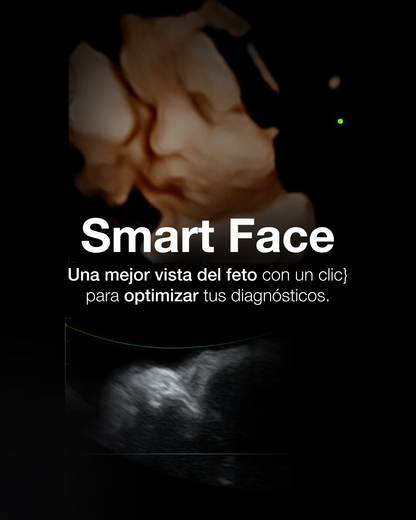 Equipo de ultrasonido DC30 Full HD Mindray