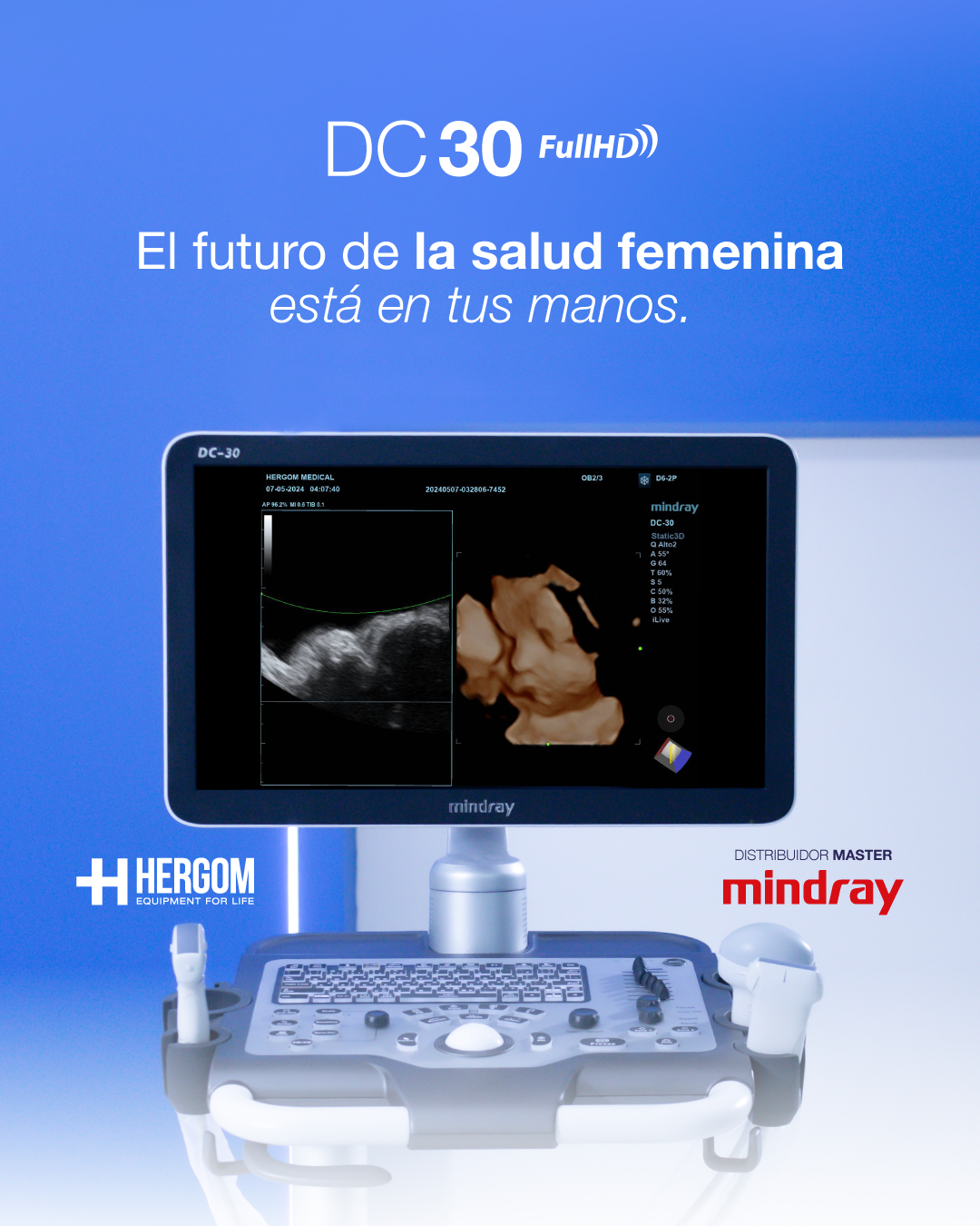 Equipo de ultrasonido DC30 Full HD Mindray