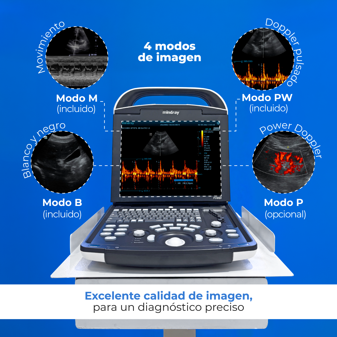 Ultrasonido Portátil Veterinario DP10 VET Mindray
