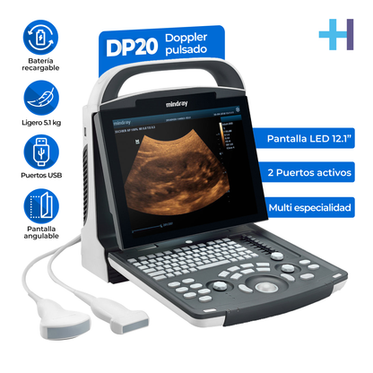 Ultrasonido Portátil para Uso Humano DP20 con función Doppler Pulsado y mejoradores de imagen iBeam y iClear Mindray