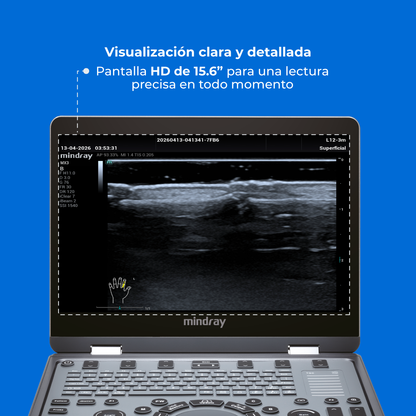 Ultrasonido Portátil MX3 Mindray con Tecnología ZST+ | Ecógrafo Profesional de Diagnóstico | Mindray