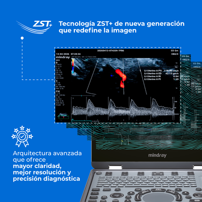 Ultrasonido Portátil MX3 Mindray con Tecnología ZST+ | Ecógrafo Profesional de Diagnóstico | Mindray