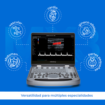 Ultrasonido Portátil MX3 Mindray con Tecnología ZST+ | Ecógrafo Profesional de Diagnóstico | Mindray