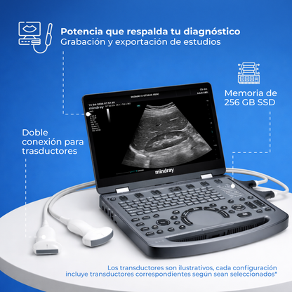 Ultrasonido Portátil MX3 Mindray con Tecnología ZST+ | Ecógrafo Profesional de Diagnóstico | Mindray
