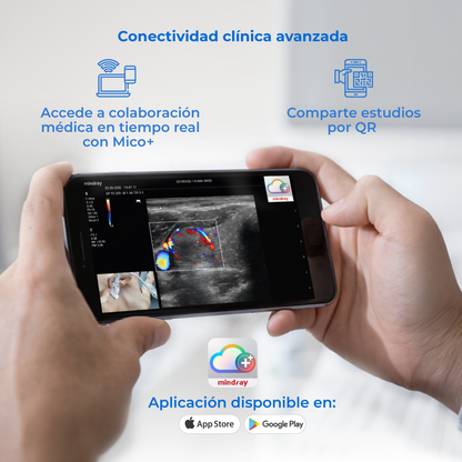 Ultrasonido Portátil MX3 Mindray con Tecnología ZST+ | Ecógrafo Profesional de Diagnóstico | Mindray