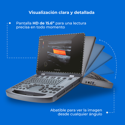Ultrasonido Portátil MX6 con Tecnología ZST+ | Ecógrafo Profesional con Doppler y 3D/4D | Mindray