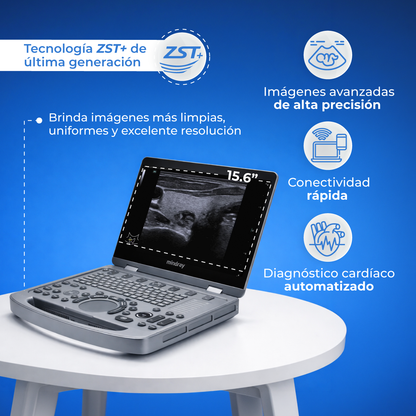 Ultrasonido Portátil MX6 con Tecnología ZST+ | Ecógrafo Profesional con Doppler y 3D/4D | Mindray
