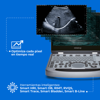 Ultrasonido Portátil MX6 con Tecnología ZST+ | Ecógrafo Profesional con Doppler y 3D/4D | Mindray