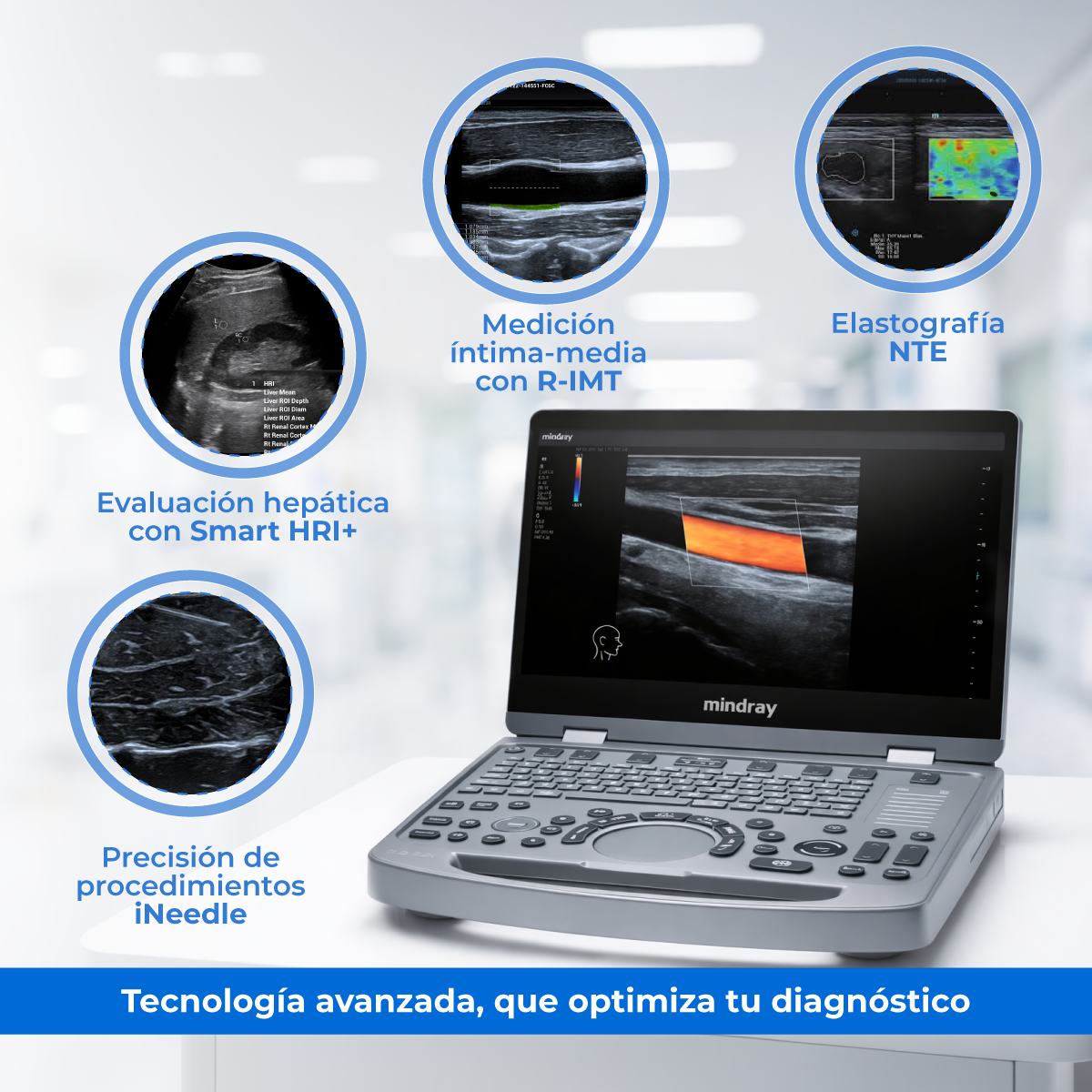 Ultrasonido Portátil MX6 con Tecnología ZST+ | Ecógrafo Profesional con Doppler y 3D/4D | Mindray