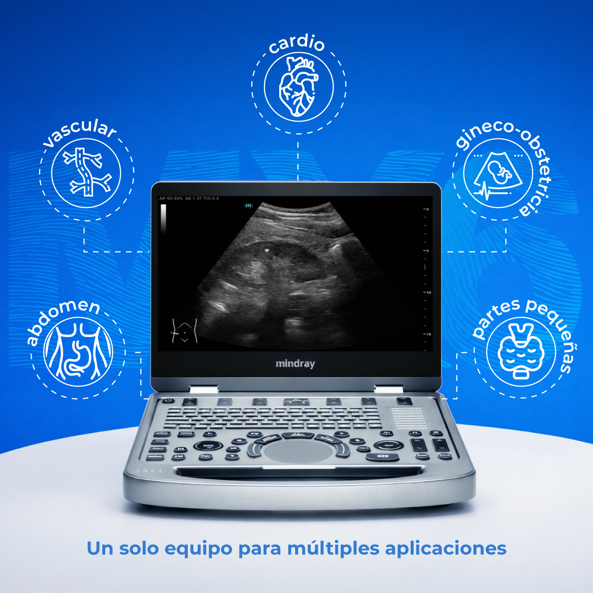 Ultrasonido Portátil MX6 con Tecnología ZST+ | Ecógrafo Profesional con Doppler y 3D/4D | Mindray