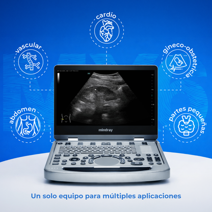 Ultrasonido Portátil MX6 con Tecnología ZST+ | Ecógrafo Profesional con Doppler y 3D/4D | Mindray