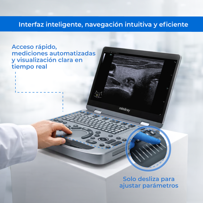 Ultrasonido Portátil MX6 con Tecnología ZST+ | Ecógrafo Profesional con Doppler y 3D/4D | Mindray