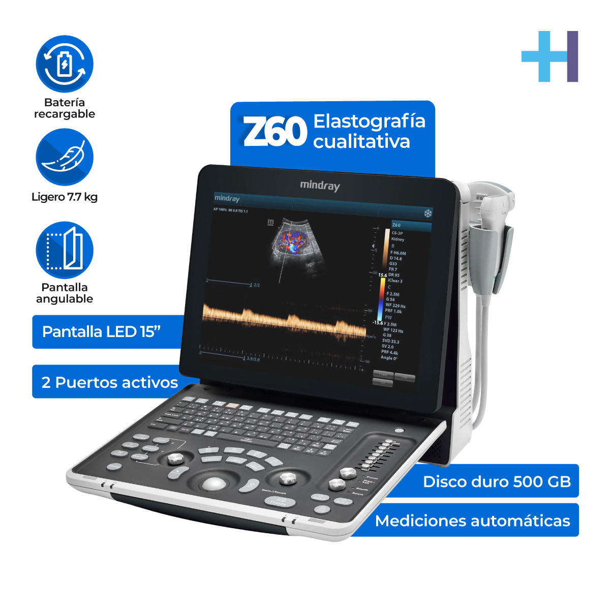 Equipo de ultrasonido portátil de ecografía para uso humano modelo Z60 + Transductores Convexo, Endocavitario y Lineal - Marca Mindray