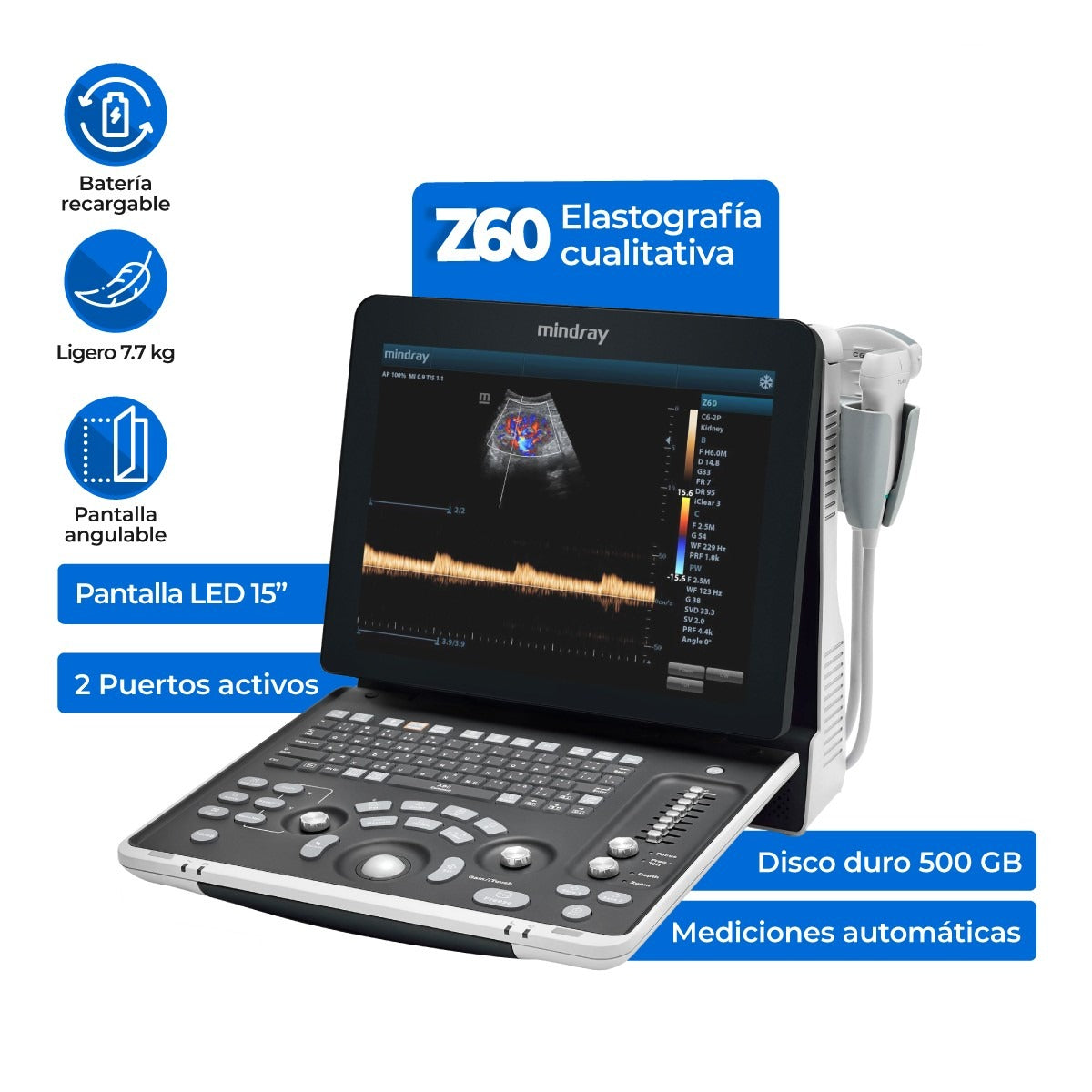 Equipo de ultrasonido portátil de ecografía para uso humano modelo Z60 Mindray