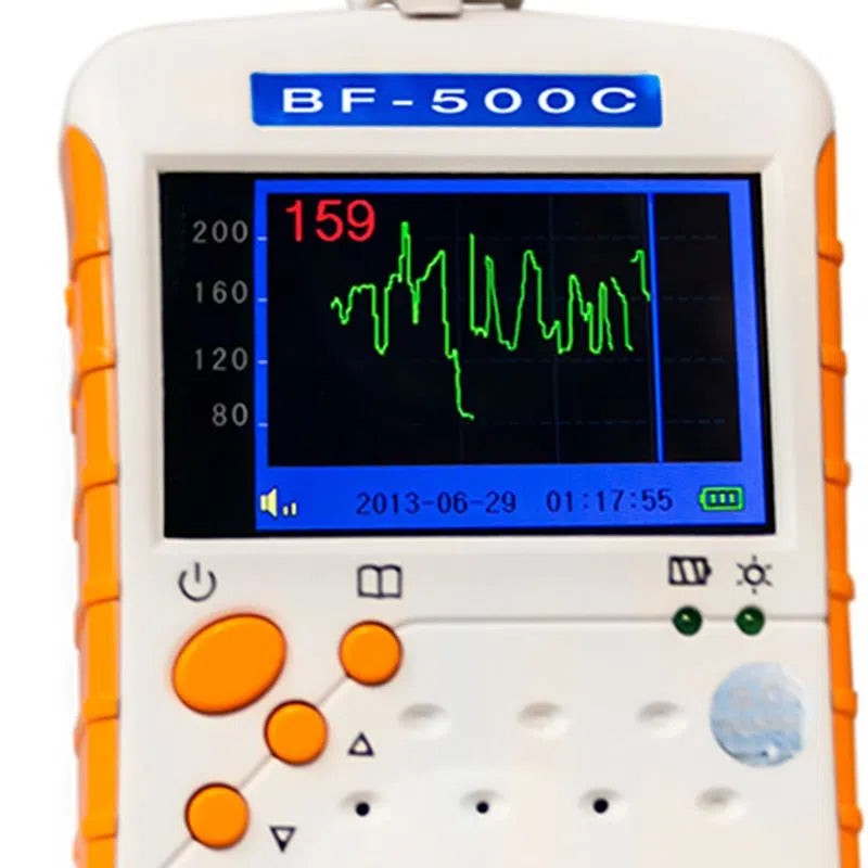 Doppler de bolsillo con pantalla 2 mhz Bestman