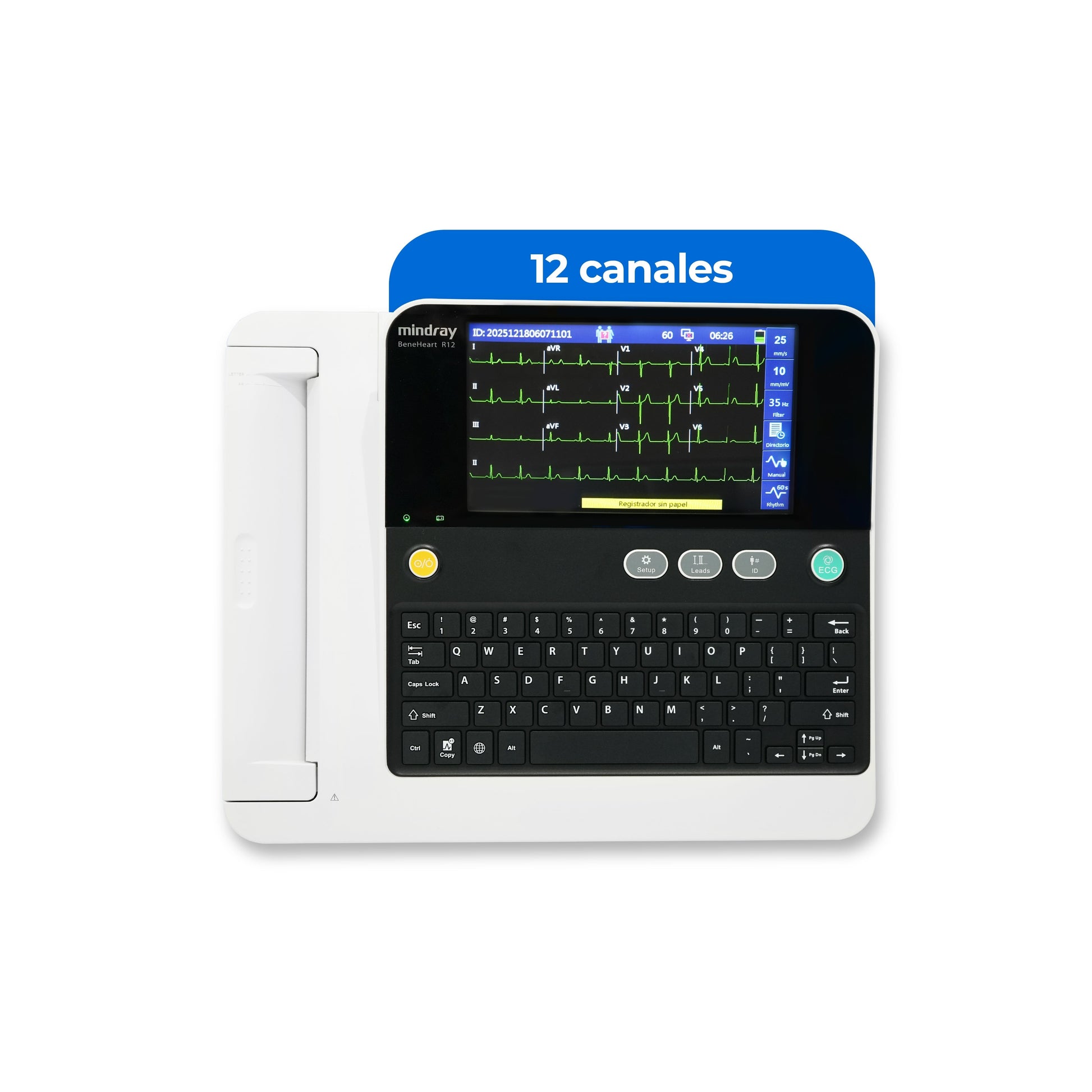 Electrocardiógrafo de 12 Canales y Algoritmo Glasgow, Pantalla 8 Pulgadas de Alta Resolución / BeneHeart R12 ECG Marca Mindray