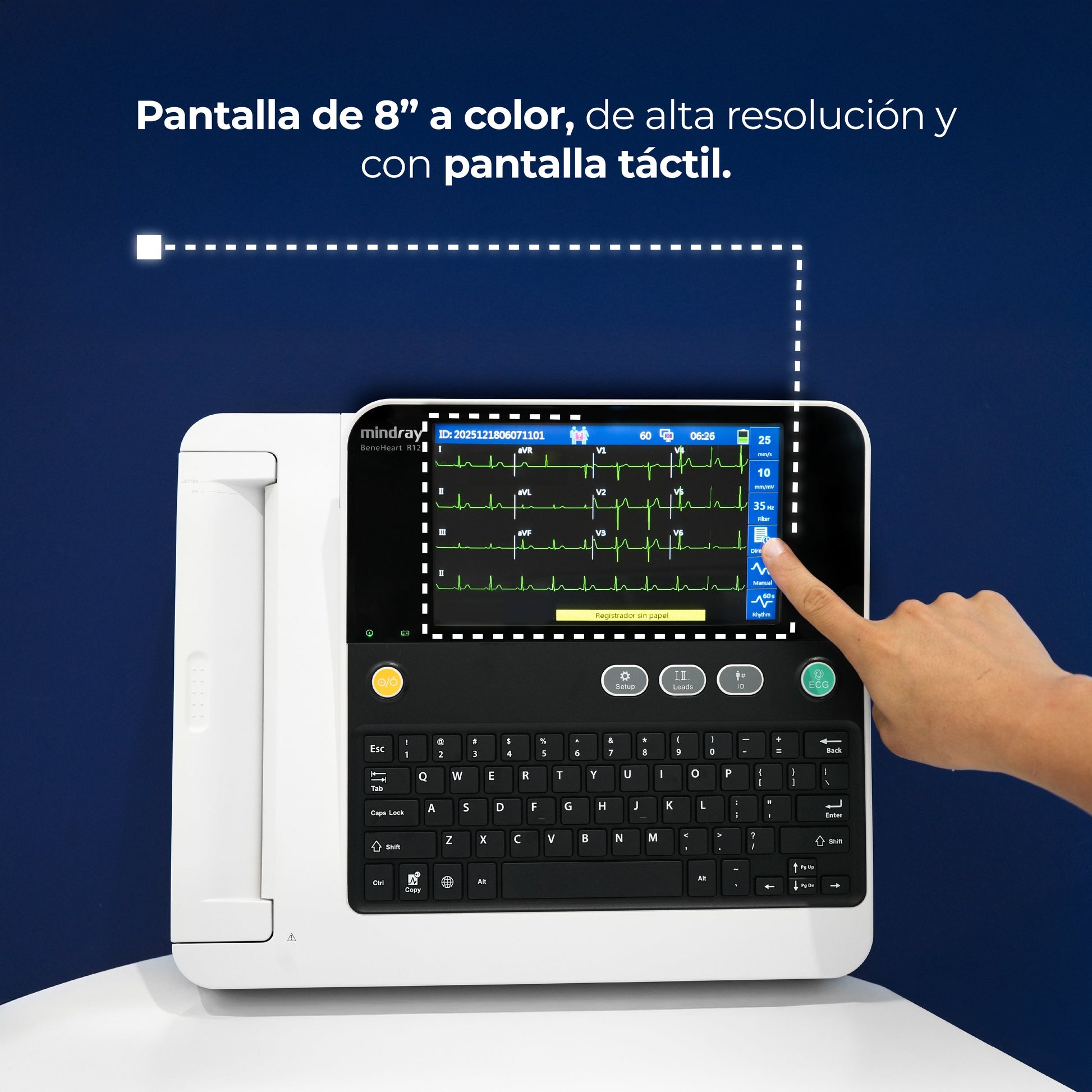 Electrocardiógrafo de 12 Canales y Algoritmo Glasgow, Pantalla 8 Pulgadas de Alta Resolución / BeneHeart R12 ECG Marca Mindray