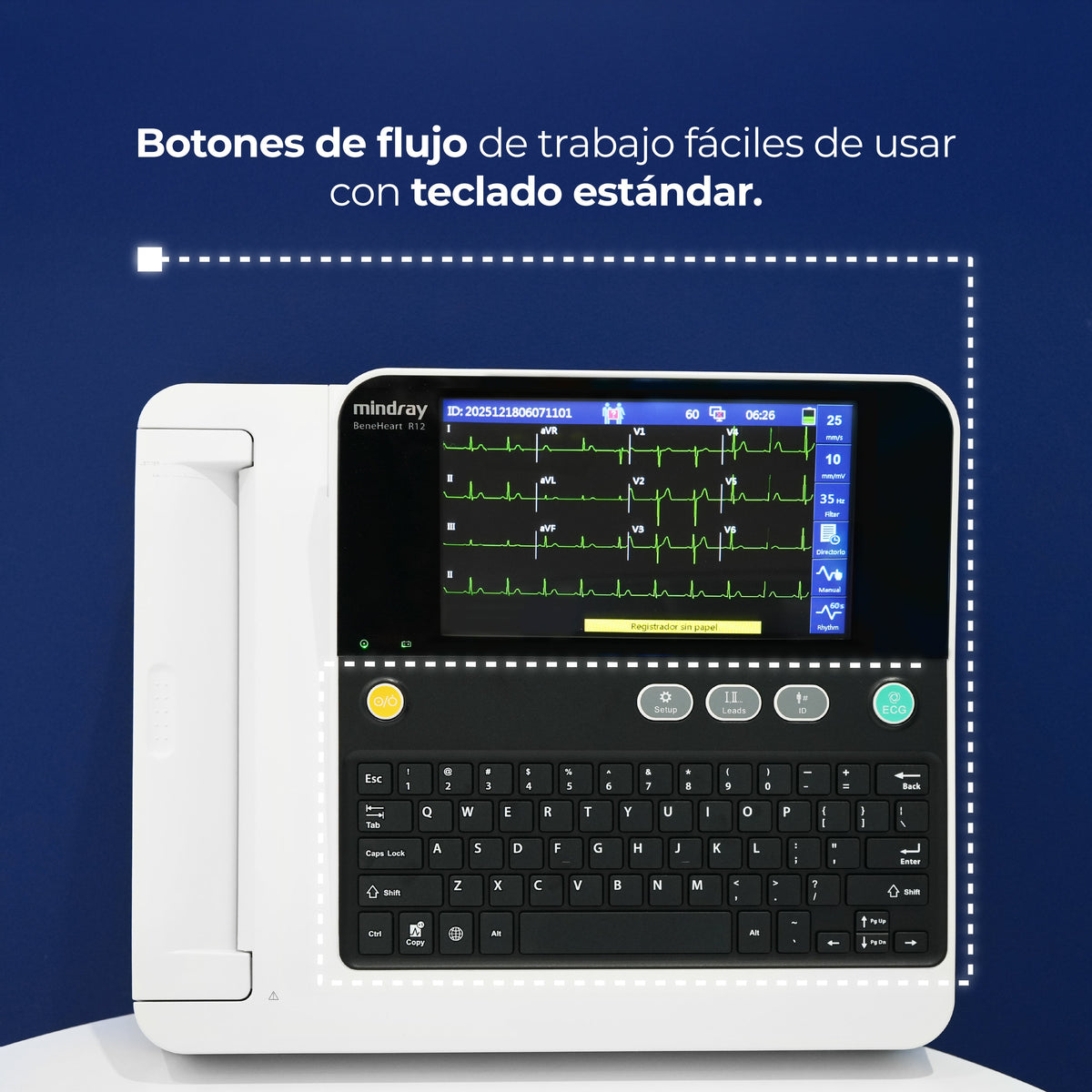 Electrocardiógrafo de 12 Canales y Algoritmo Glasgow, Pantalla 8 Pulgadas de Alta Resolución / BeneHeart R12 ECG Marca Mindray