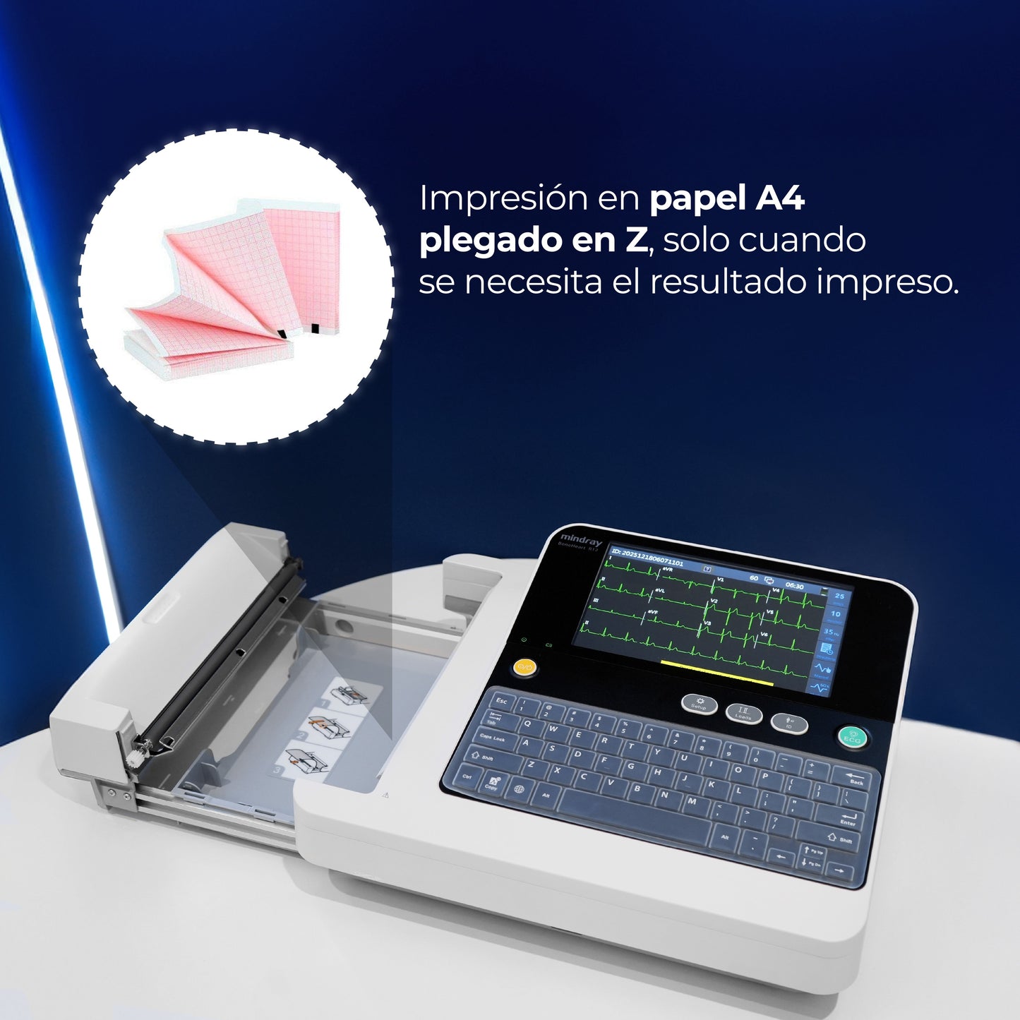 Electrocardiógrafo de 12 Canales y Algoritmo Glasgow, Pantalla 8 Pulgadas de Alta Resolución / BeneHeart R12 ECG Marca Mindray