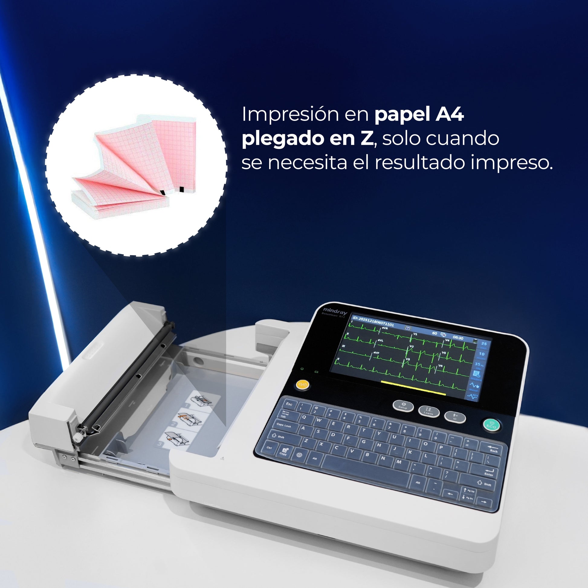 Electrocardiógrafo de 12 Canales y Algoritmo Glasgow, Pantalla 8 Pulgadas de Alta Resolución / BeneHeart R12 ECG Marca Mindray
