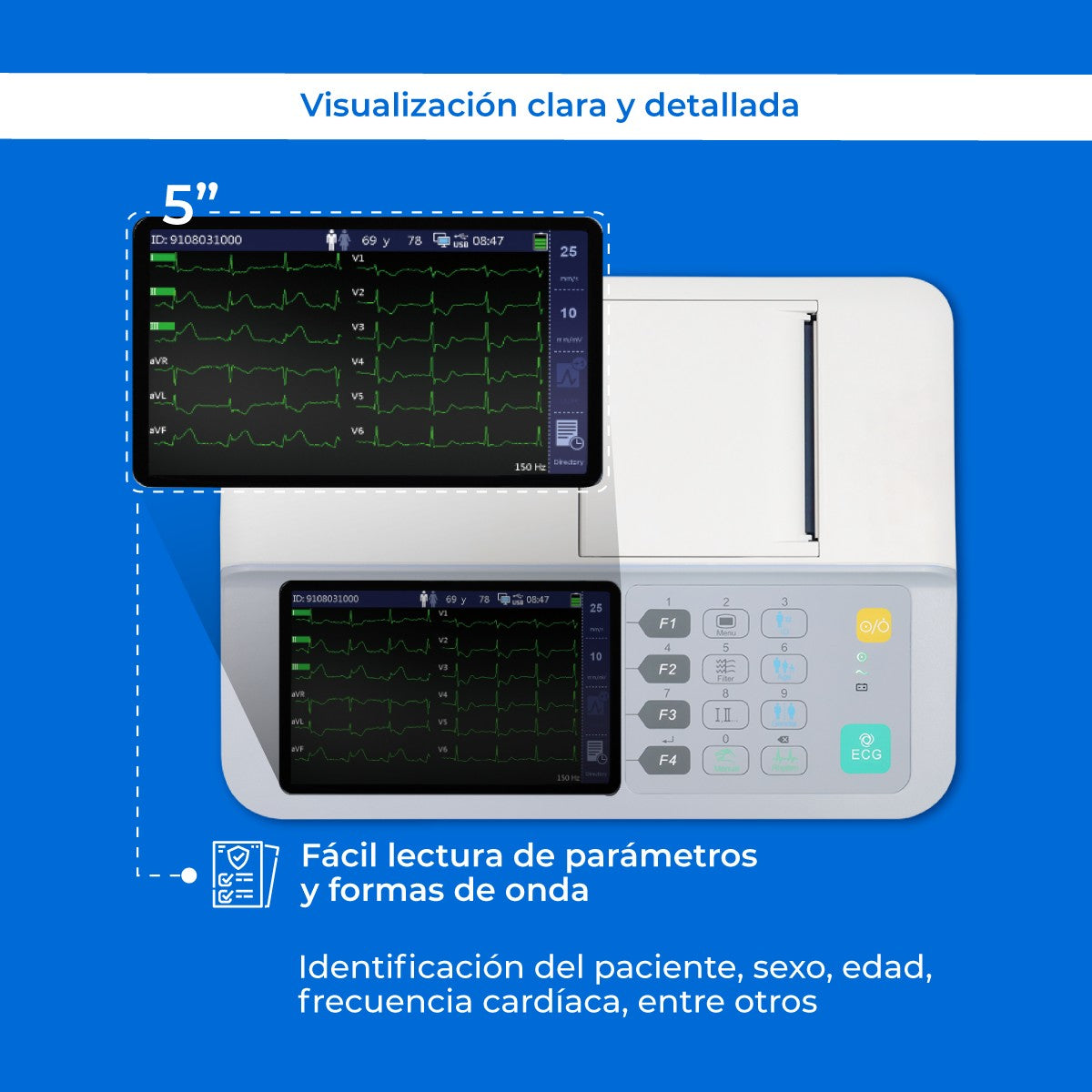 Electrocardiógrafo Portátil de 3 Canales, Pantalla 5 Pulgadas y Alta Resolución / BeneHeart R3 ECG Marca Mindray