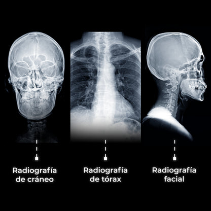Equipo de Rayos X Portátil con Batería Recargable | Uso Humano | Serie DRX3 | Ligero y Portátil SIUI