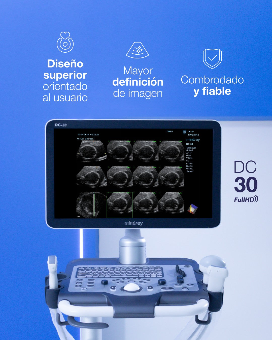 Equipo de ultrasonido DC30 Full HD Mindray