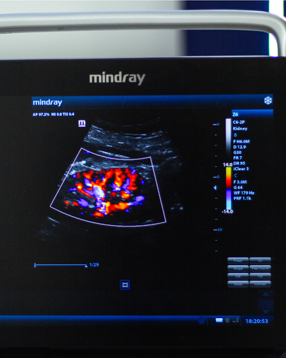 Equipo de ultrasonido portátil de ecografía para uso humano modelo Z60 Mindray