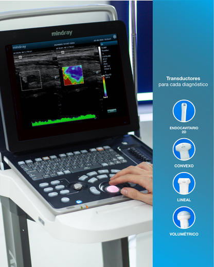 Equipo de ultrasonido portátil de ecografía para uso humano modelo Z60 Mindray