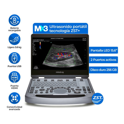 Ultrasonido Portátil MX3 Mindray con Tecnología ZST+ | Ecógrafo Profesional de Diagnóstico | Mindray