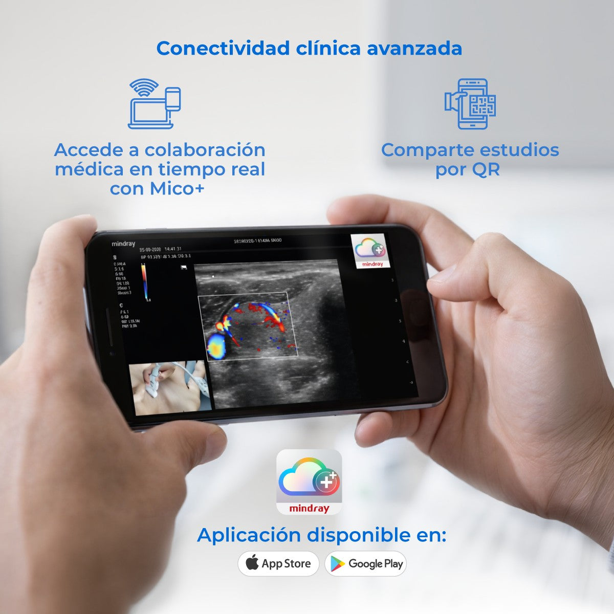 Ultrasonido Portátil MX3 Mindray con Tecnología ZST+ | Ecógrafo Profesional de Diagnóstico | Mindray