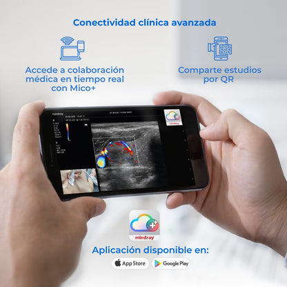 Ultrasonido Portátil MX3 Mindray con Tecnología ZST+ | Ecógrafo Profesional de Diagnóstico | Mindray