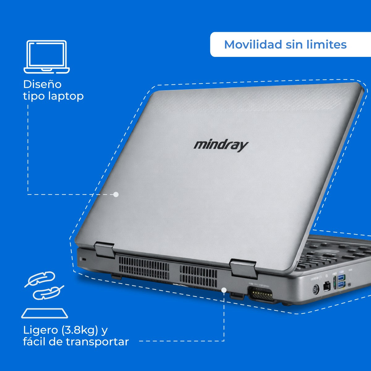 Ultrasonido Portátil MX3 Mindray con Tecnología ZST+ | Ecógrafo Profesional de Diagnóstico | Mindray