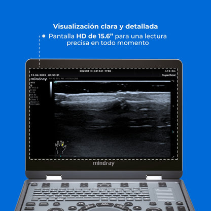 Ultrasonido Portátil MX3 Mindray con Tecnología ZST+ | Ecógrafo Profesional de Diagnóstico | Mindray