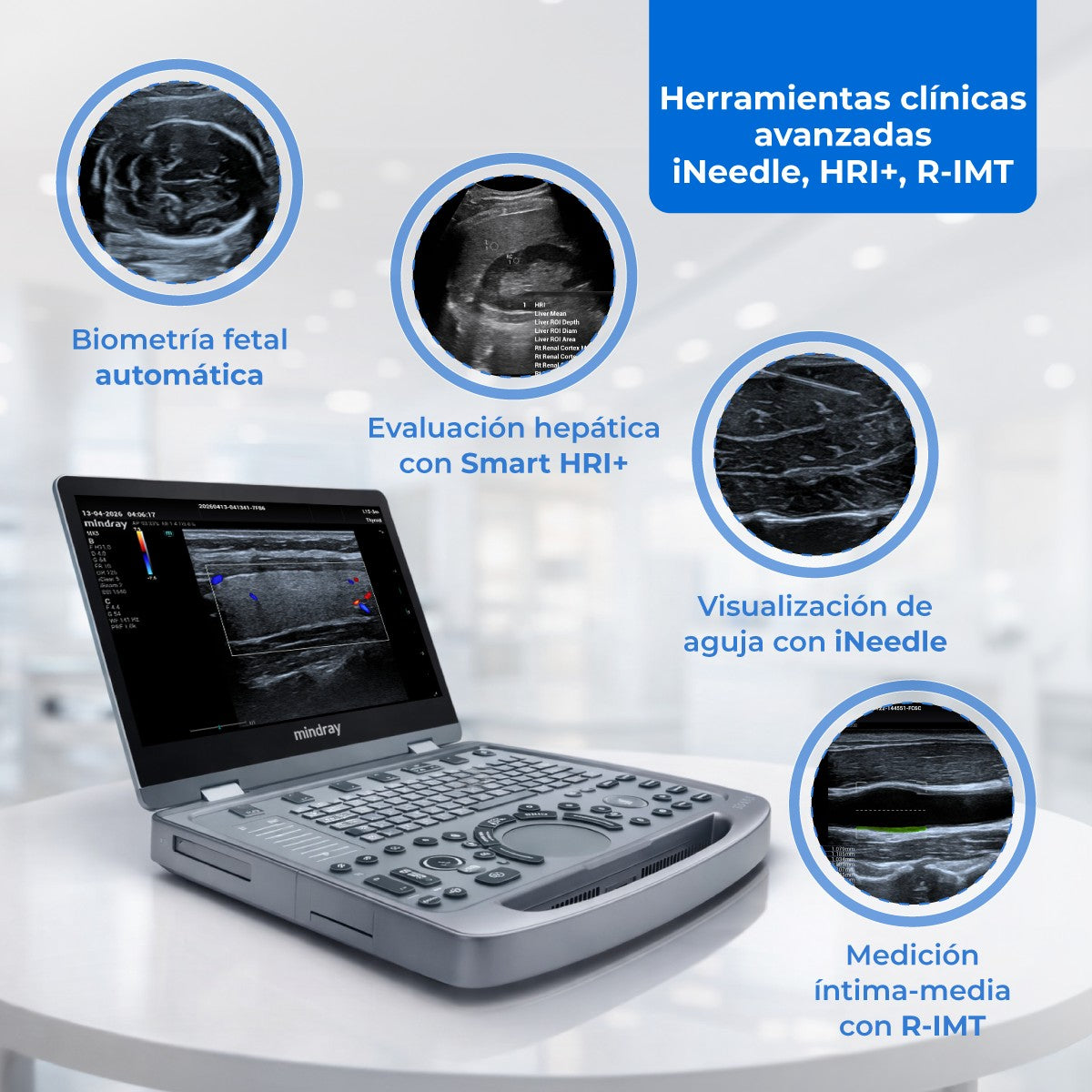 Ultrasonido Portátil MX3 Mindray con Tecnología ZST+ | Ecógrafo Profesional de Diagnóstico | Mindray