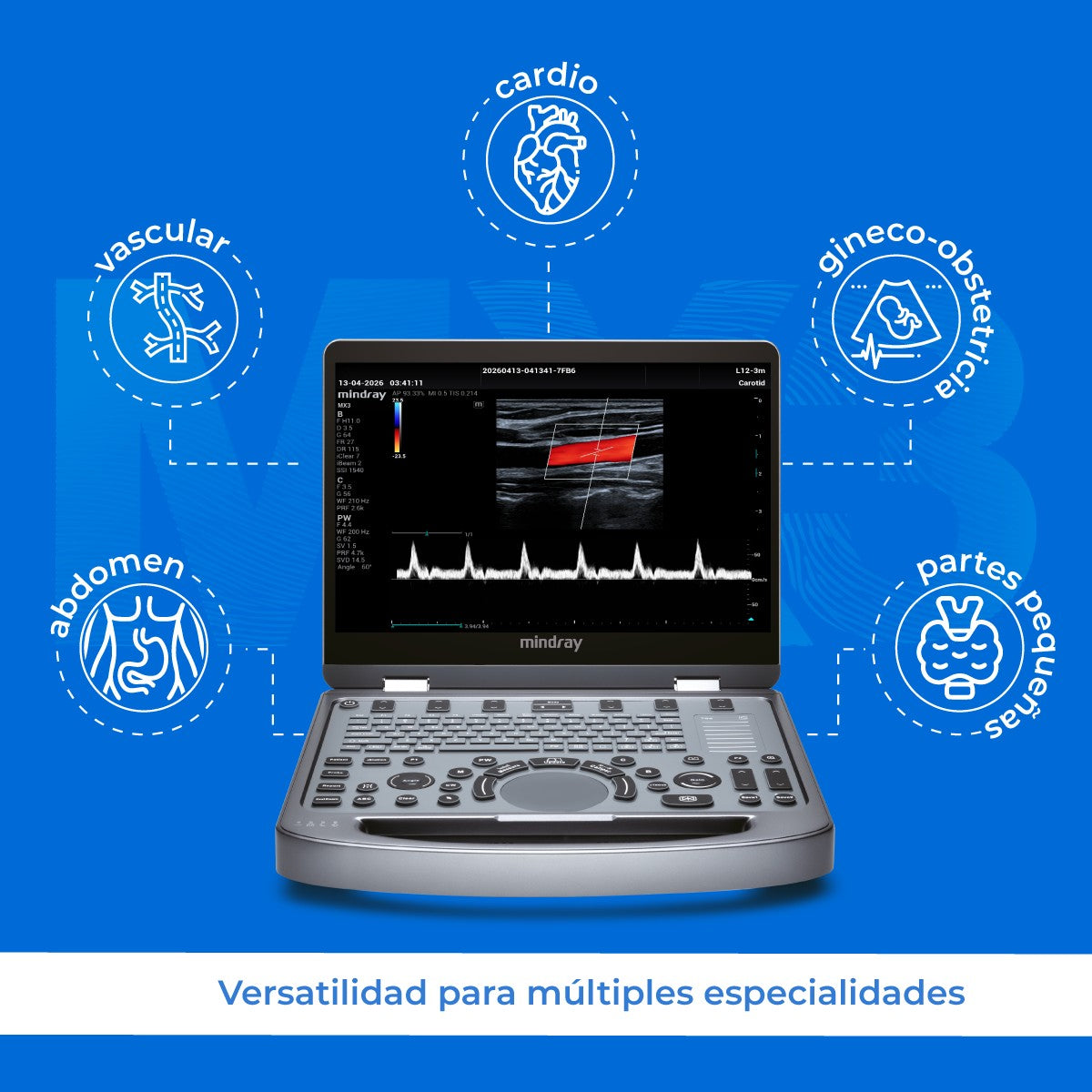 Ultrasonido Portátil MX3 Mindray con Tecnología ZST+ | Ecógrafo Profesional de Diagnóstico | Mindray