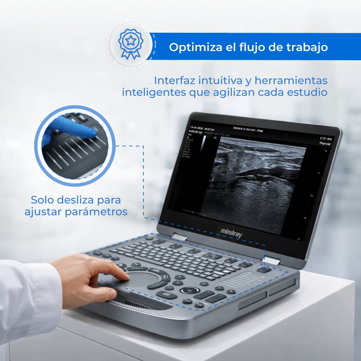 Ultrasonido Portátil MX3 Mindray con Tecnología ZST+ | Ecógrafo Profesional de Diagnóstico | Mindray