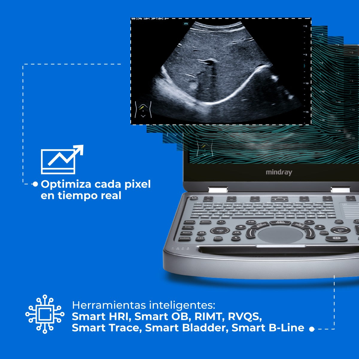 Ultrasonido Portátil MX6 con Tecnología ZST+ | Ecógrafo Profesional con Doppler y 3D/4D | Mindray