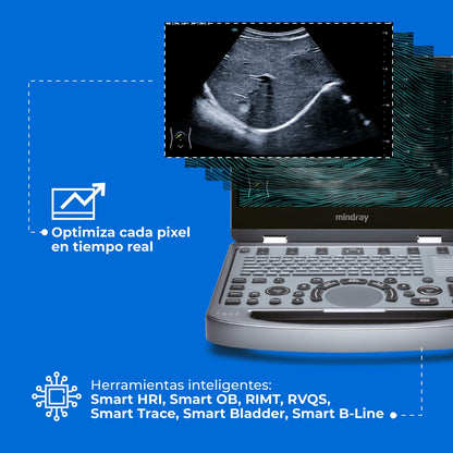 Ultrasonido Portátil MX6 con Tecnología ZST+ | Ecógrafo Profesional con Doppler y 3D/4D | Mindray