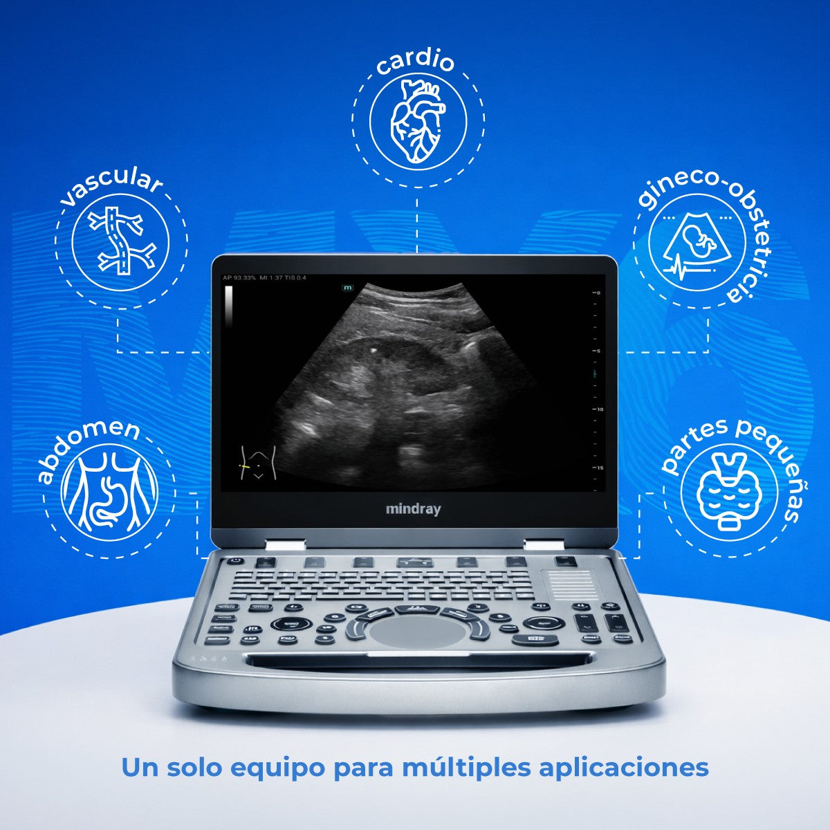 Ultrasonido Portátil MX6 con Tecnología ZST+ | Ecógrafo Profesional con Doppler y 3D/4D | Mindray