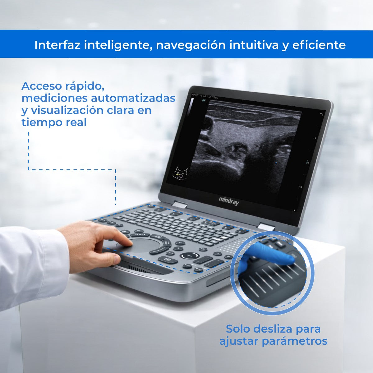 Ultrasonido Portátil MX6 con Tecnología ZST+ | Ecógrafo Profesional con Doppler y 3D/4D | Mindray