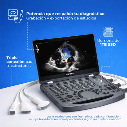 Ultrasonido Portátil MX6 con Tecnología ZST+ | Ecógrafo Profesional con Doppler y 3D/4D | Mindray