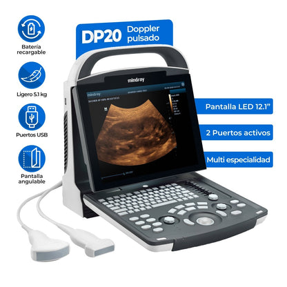 Ultrasonido Portátil para Uso Humano DP20 con función Doppler Pulsado y mejoradores de imagen iBeam y iClear Mindray