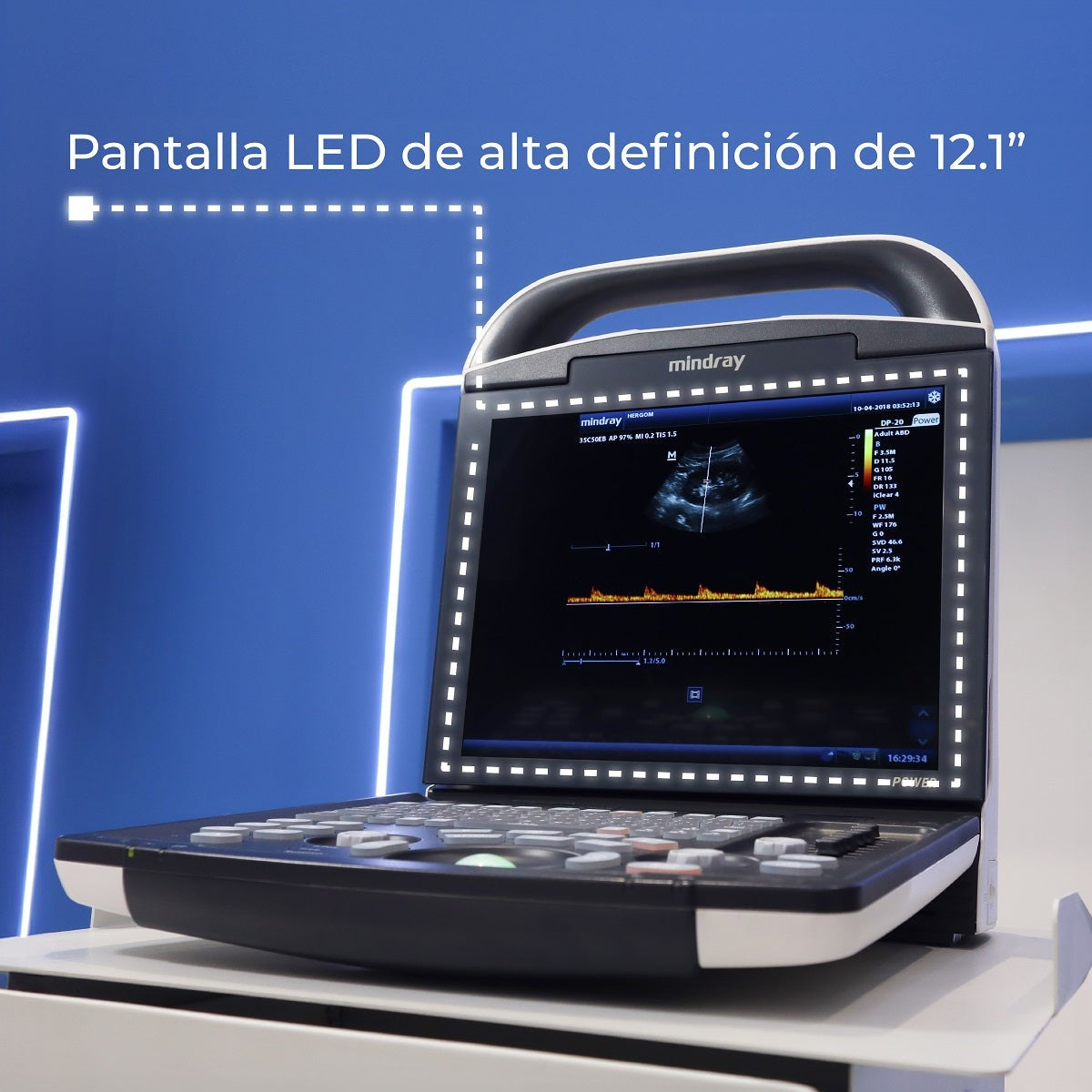 Ultrasonido Portátil para Uso Humano DP20 con función Doppler Pulsado y mejoradores de imagen iBeam y iClear Mindray