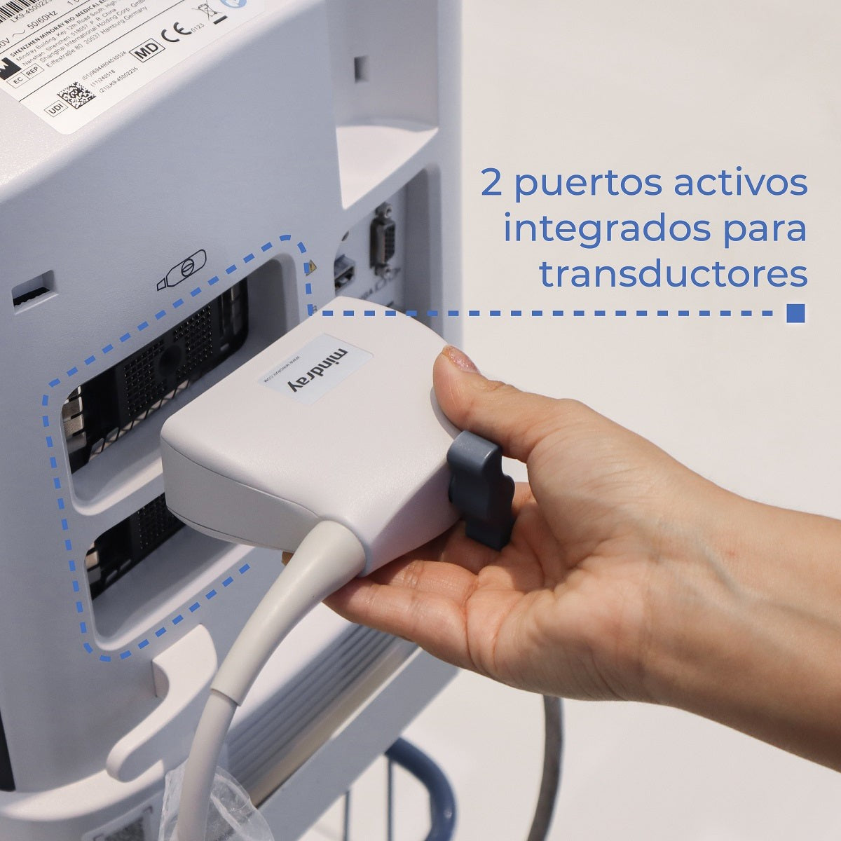 Ultrasonido Portátil para Uso Humano DP20 con función Doppler Pulsado y mejoradores de imagen iBeam y iClear Mindray
